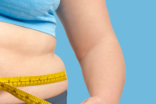 מהי השמנת יתר ולמה היא כל כך מסוכנת לבריאות שלכם?